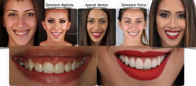 caz neoclinique estetica dentara