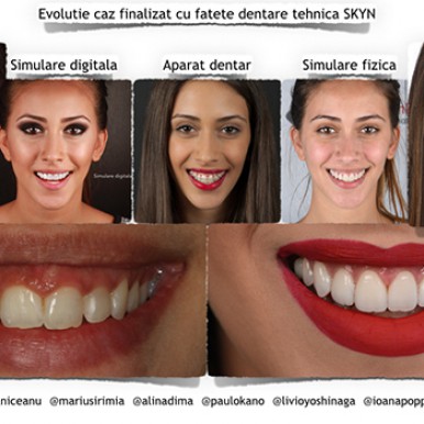 caz neoclinique estetica dentara