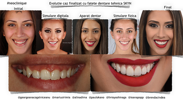 caz neoclinique estetica dentara