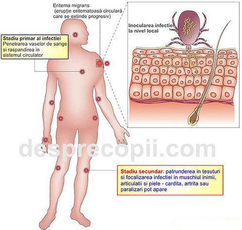 infectie muscatura de capusa